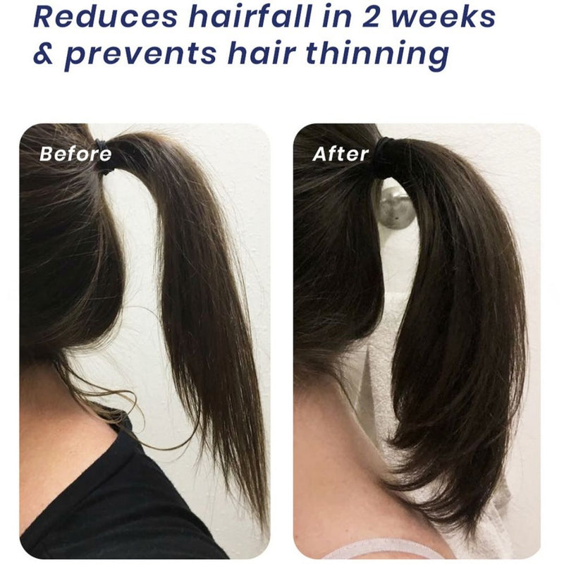 Nuvio Hair Growth Treatment